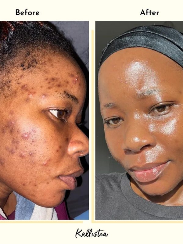 61f7b66eebac06667176ee4b416172e7